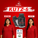 Biogenesiss™ KUTZ 6 – Advanced Fat Burner | 60 Tablets | Women